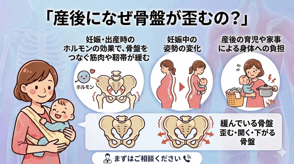 産後になぜ骨盤が歪むのかを説明した画像
妊娠・出産時にでるホルモンの効果で骨盤をつないでいる筋肉や靭帯が緩む
妊娠中の姿勢の変化
出産後の育児や家事による身体への負担